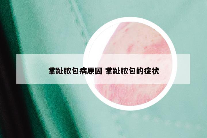 掌趾脓包病原因 掌趾脓包的症状
