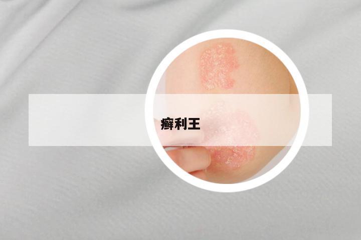 癣利王