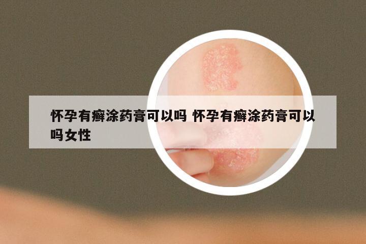 怀孕有癣涂药膏可以吗 怀孕有癣涂药膏可以吗女性