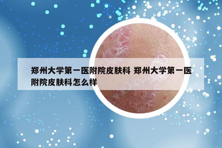 郑州大学第一医附院皮肤科 郑州大学第一医附院皮肤科怎么样
