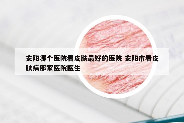 安阳哪个医院看皮肤最好的医院 安阳市看皮肤病那家医院医生