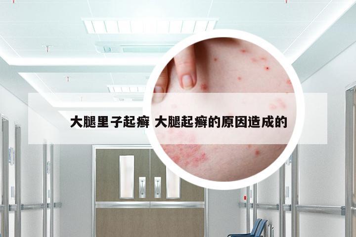 大腿里子起癣 大腿起癣的原因造成的