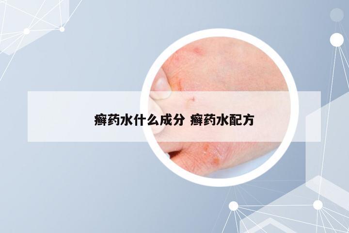 癣药水什么成分 癣药水配方