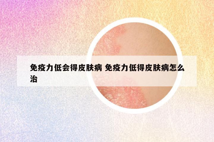 免疫力低会得皮肤病 免疫力低得皮肤病怎么治