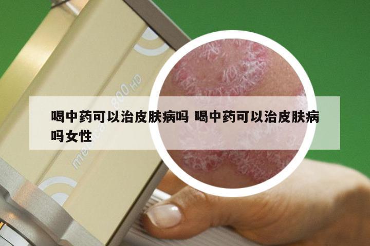喝中药可以治皮肤病吗 喝中药可以治皮肤病吗女性