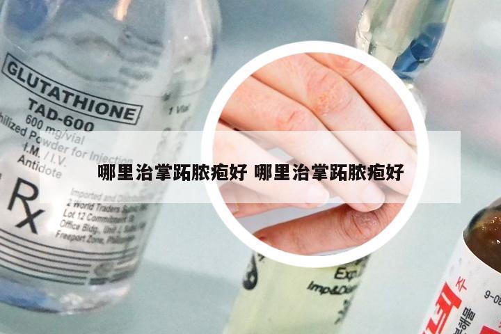 哪里治掌跖脓疱好 哪里治掌跖脓疱好