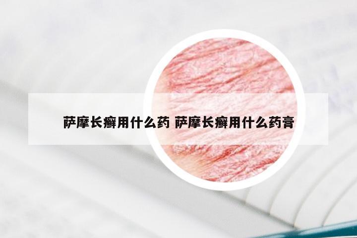 萨摩长癣用什么药 萨摩长癣用什么药膏