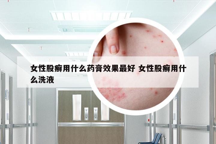 女性股癣用什么药膏效果最好 女性股癣用什么洗液