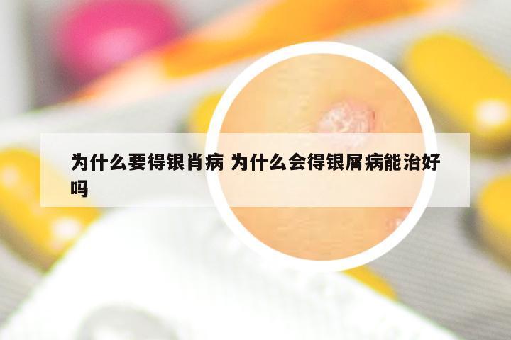 为什么要得银肖病 为什么会得银屑病能治好吗