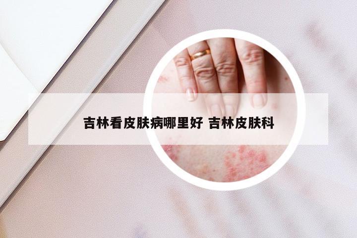 吉林看皮肤病哪里好 吉林皮肤科
