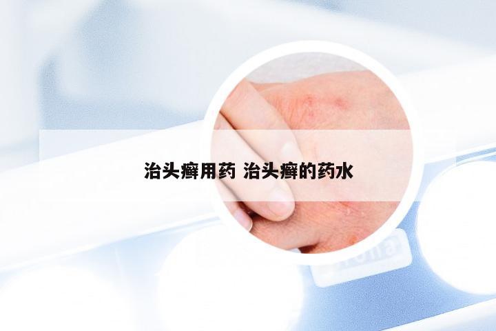 治头癣用药 治头癣的药水