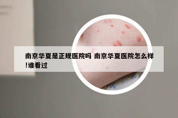 南京华夏是正规医院吗 南京华夏医院怎么样!谁看过
