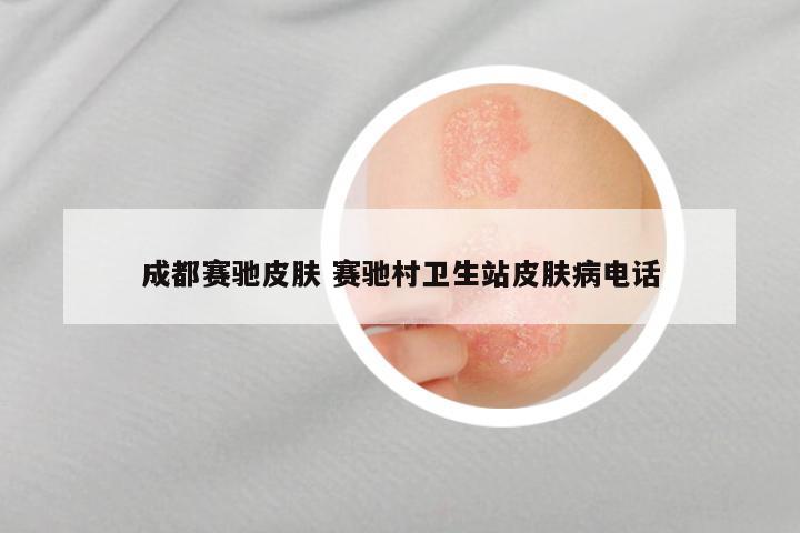 成都赛驰皮肤 赛驰村卫生站皮肤病电话