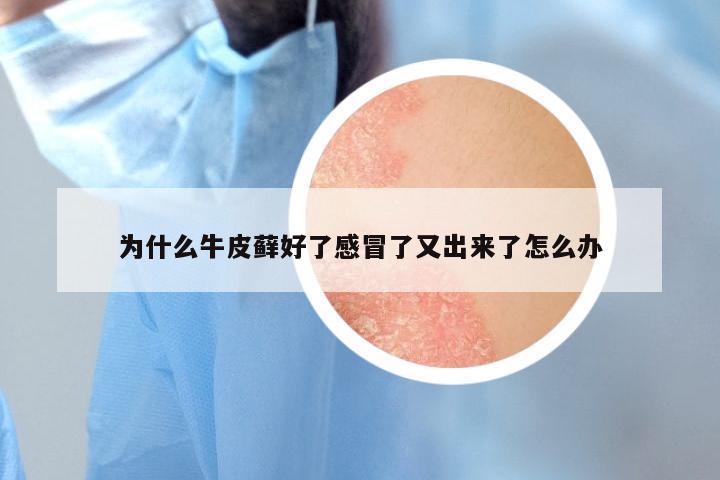 为什么牛皮藓好了感冒了又出来了怎么办