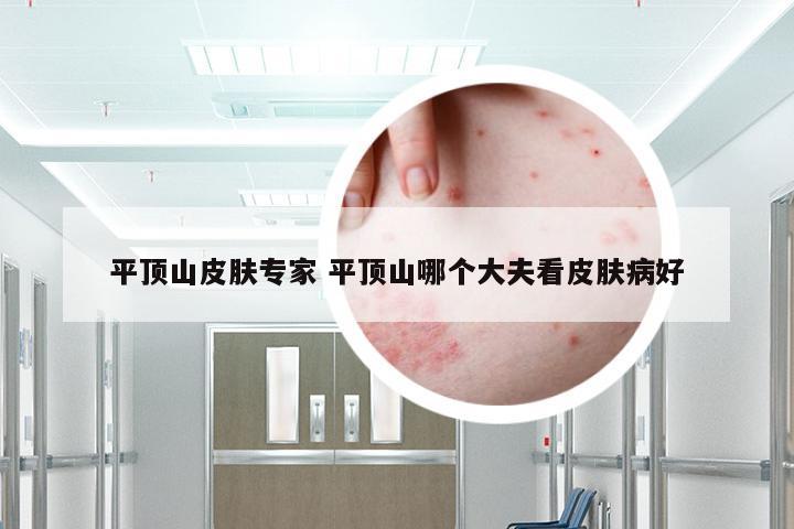 平顶山皮肤专家 平顶山哪个大夫看皮肤病好
