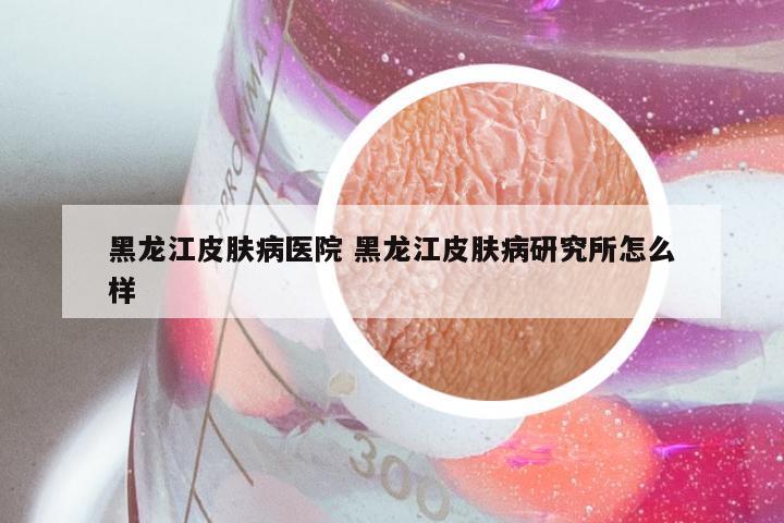 黑龙江皮肤病医院 黑龙江皮肤病研究所怎么样