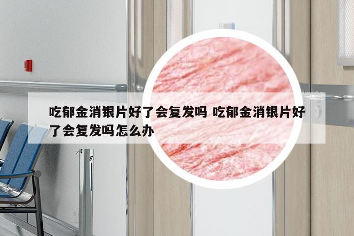 吃郁金消银片好了会复发吗 吃郁金消银片好了会复发吗怎么办