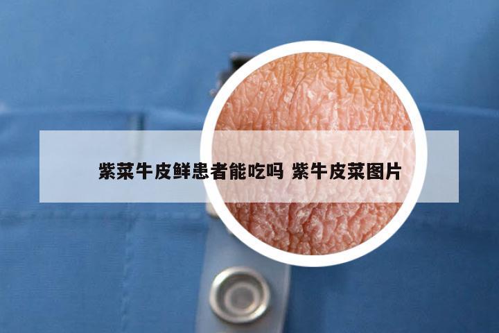 紫菜牛皮鲜患者能吃吗 紫牛皮菜图片