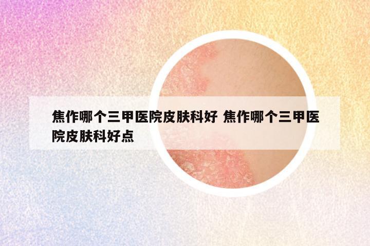 焦作哪个三甲医院皮肤科好 焦作哪个三甲医院皮肤科好点