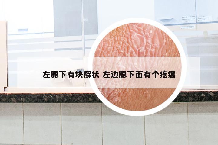 左腮下有块癣状 左边腮下面有个疙瘩