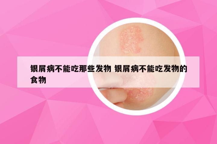 银屑病不能吃那些发物 银屑病不能吃发物的食物