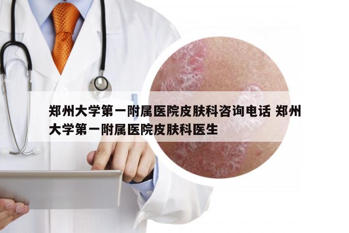 郑州大学第一附属医院皮肤科咨询电话 郑州大学第一附属医院皮肤科医生