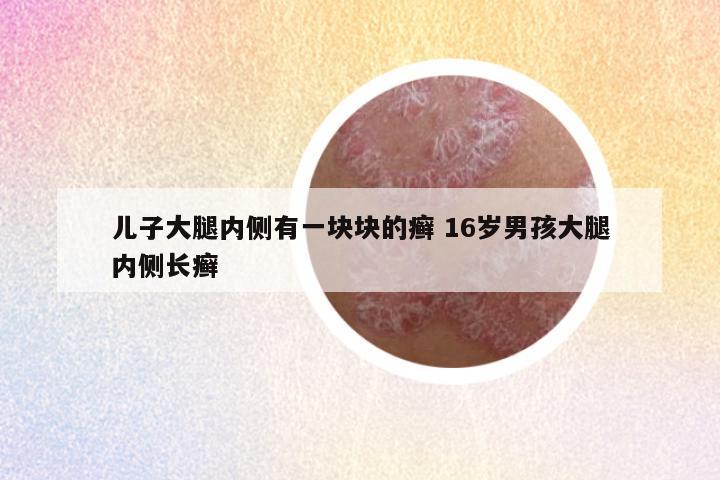 儿子大腿内侧有一块块的癣 16岁男孩大腿内侧长癣