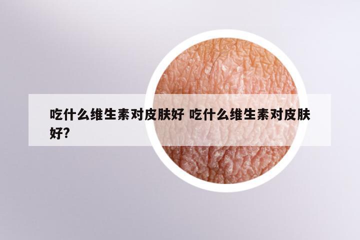 吃什么维生素对皮肤好 吃什么维生素对皮肤好?