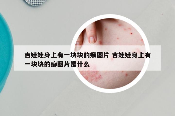 吉娃娃身上有一块块的癣图片 吉娃娃身上有一块块的癣图片是什么