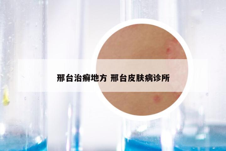 邢台治癣地方 邢台皮肤病诊所