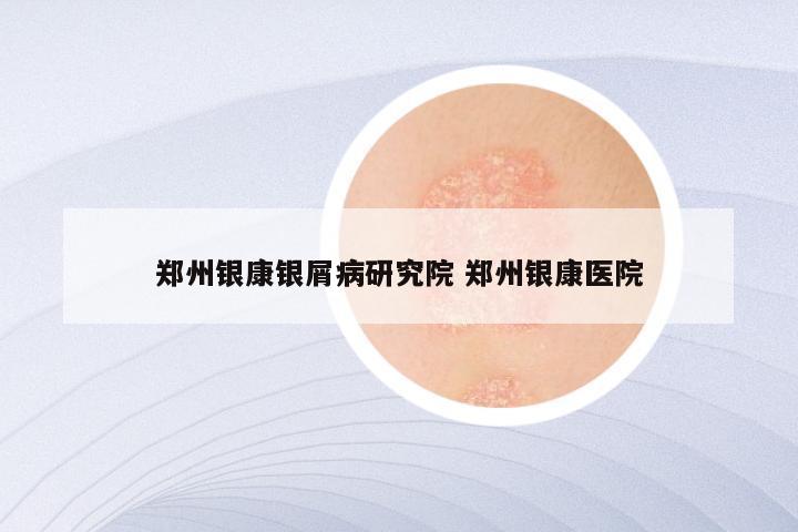 郑州银康银屑病研究院 郑州银康医院