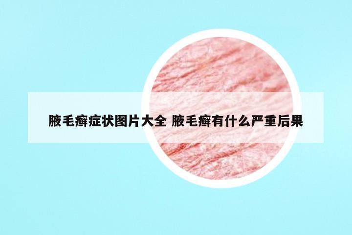 腋毛癣症状图片大全 腋毛癣有什么严重后果
