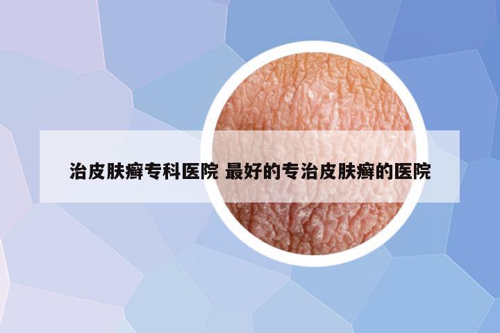 治皮肤癣专科医院 最好的专治皮肤癣的医院