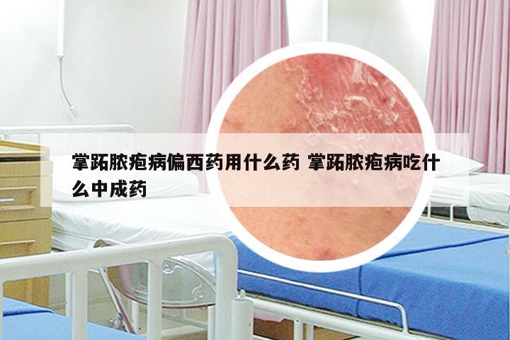 掌跖脓疱病偏西药用什么药 掌跖脓疱病吃什么中成药
