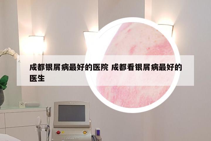 成都银屑病最好的医院 成都看银屑病最好的医生