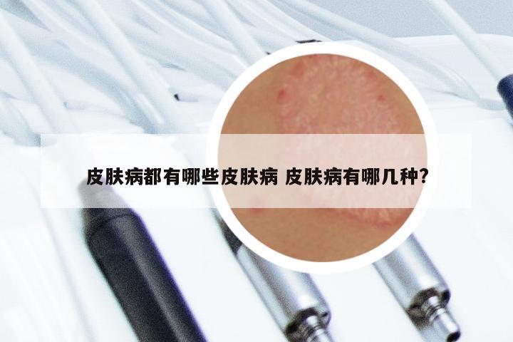 皮肤病都有哪些皮肤病 皮肤病有哪几种?