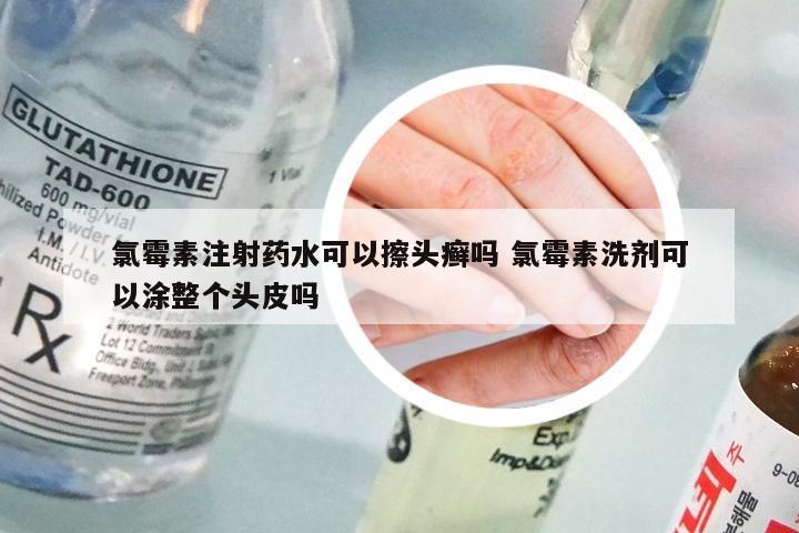 氯霉素注射药水可以擦头癣吗 氯霉素洗剂可以涂整个头皮吗