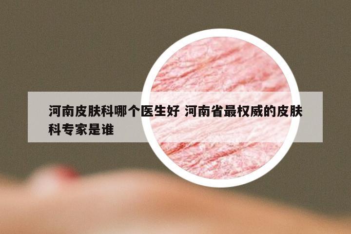 河南皮肤科哪个医生好 河南省最权威的皮肤科专家是谁