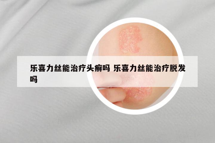 乐喜力丝能治疗头癣吗 乐喜力丝能治疗脱发吗