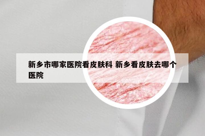 新乡市哪家医院看皮肤科 新乡看皮肤去哪个医院