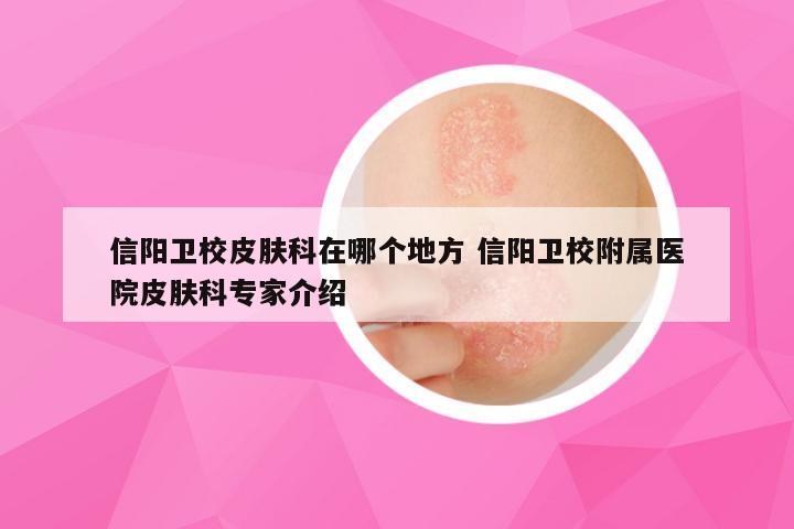 信阳卫校皮肤科在哪个地方 信阳卫校附属医院皮肤科专家介绍