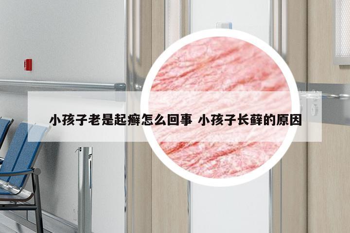 小孩子老是起癣怎么回事 小孩子长藓的原因