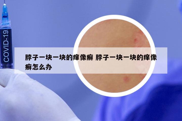 脖子一块一块的痒像癣 脖子一块一块的痒像癣怎么办