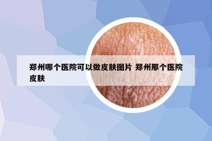 郑州哪个医院可以做皮肤图片 郑州那个医院皮肤