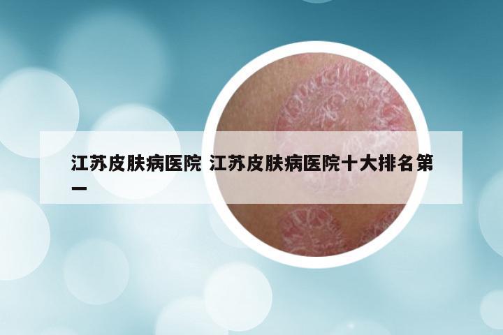 江苏皮肤病医院 江苏皮肤病医院十大排名第一