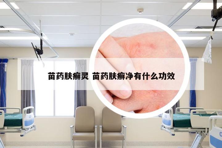 苗药肤癣灵 苗药肤癣净有什么功效