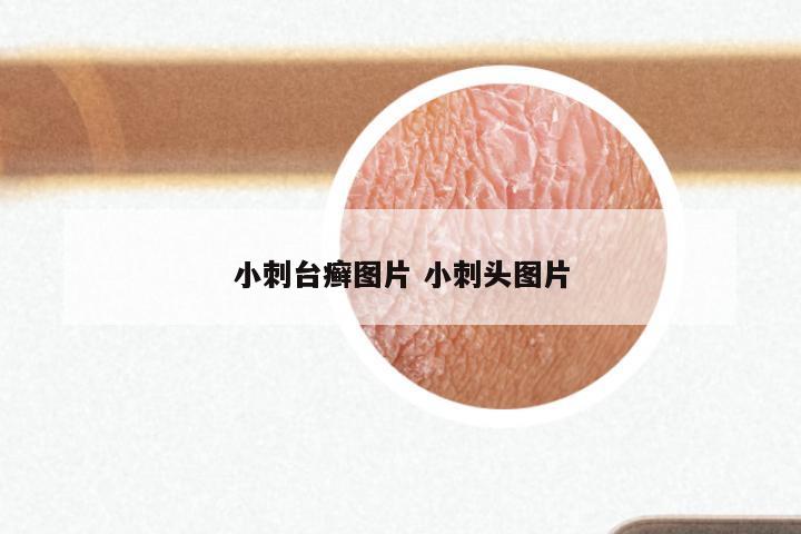 小刺台癣图片 小刺头图片