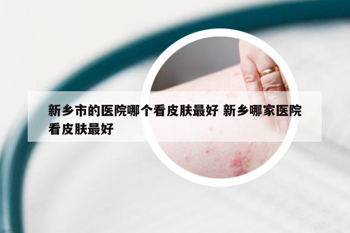 新乡市的医院哪个看皮肤最好 新乡哪家医院看皮肤最好