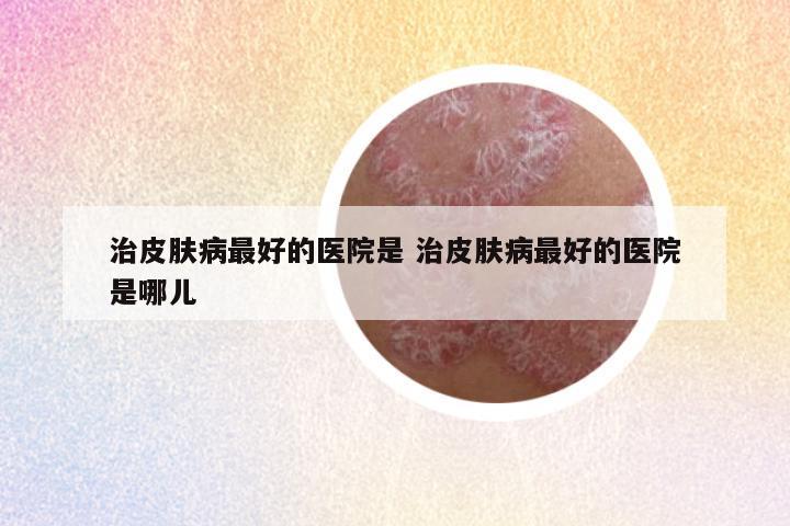 治皮肤病最好的医院是 治皮肤病最好的医院是哪儿