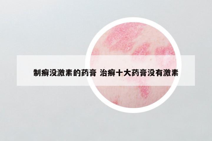 制癣没激素的药膏 治癣十大药膏没有激素